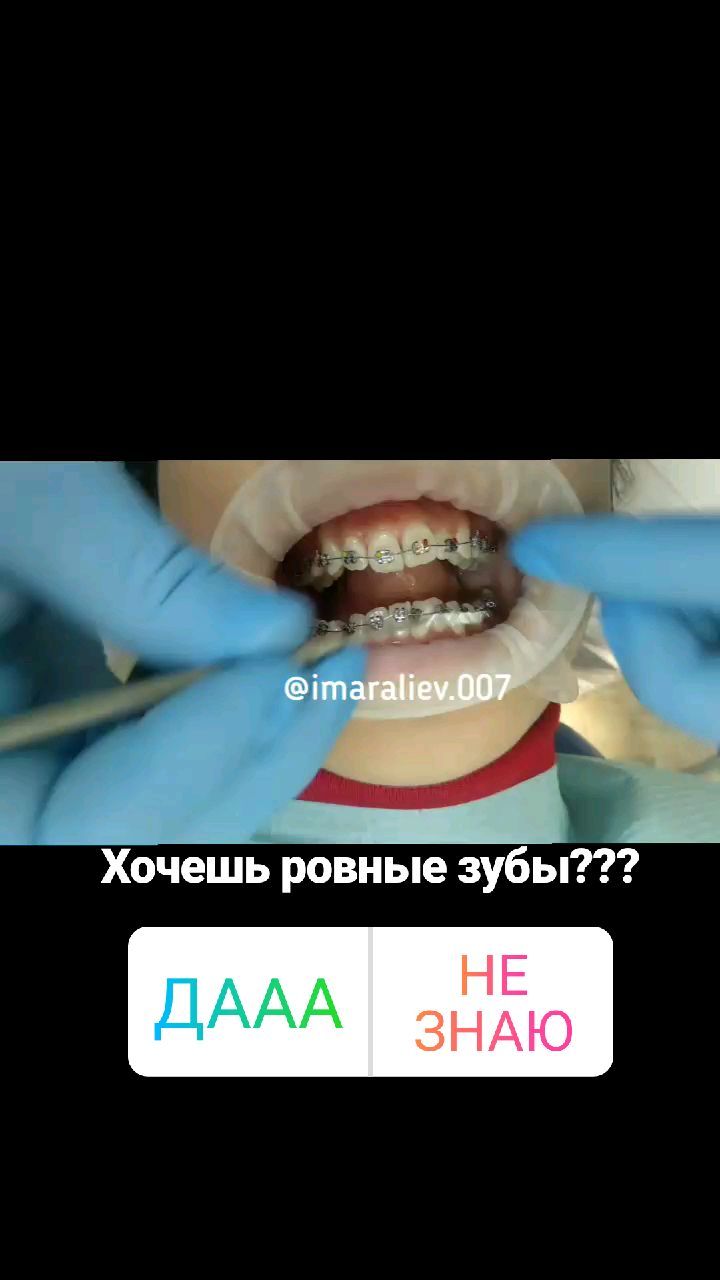 Брекеты — кейс 1