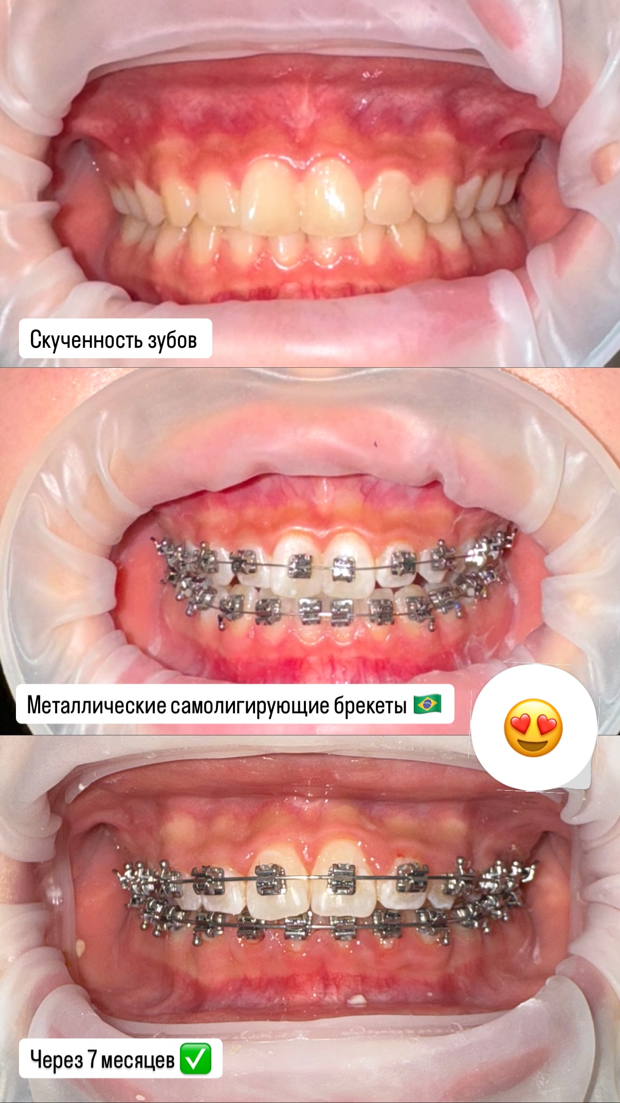 До/после — кейс 1