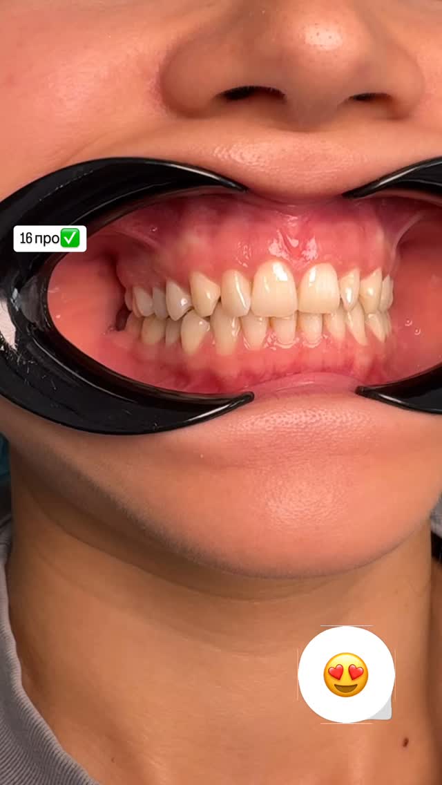 До/после 2024 — кейс 10