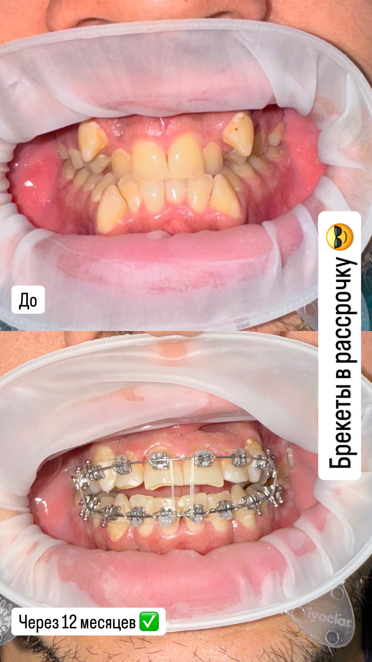 До/после — кейс 2