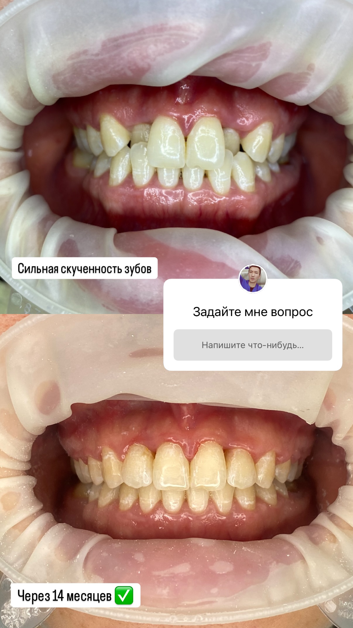 До/после 2024 — кейс 3