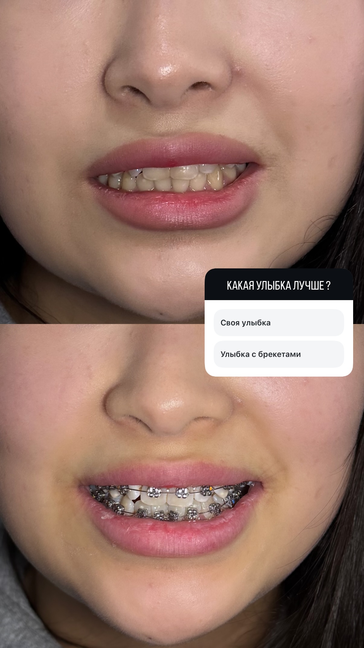 До/после 2024 — кейс 4