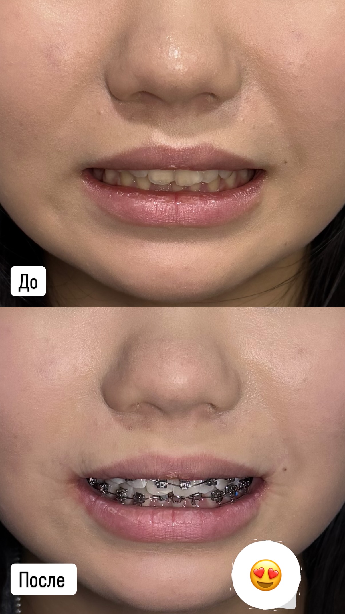 До/после 2024 — кейс 5