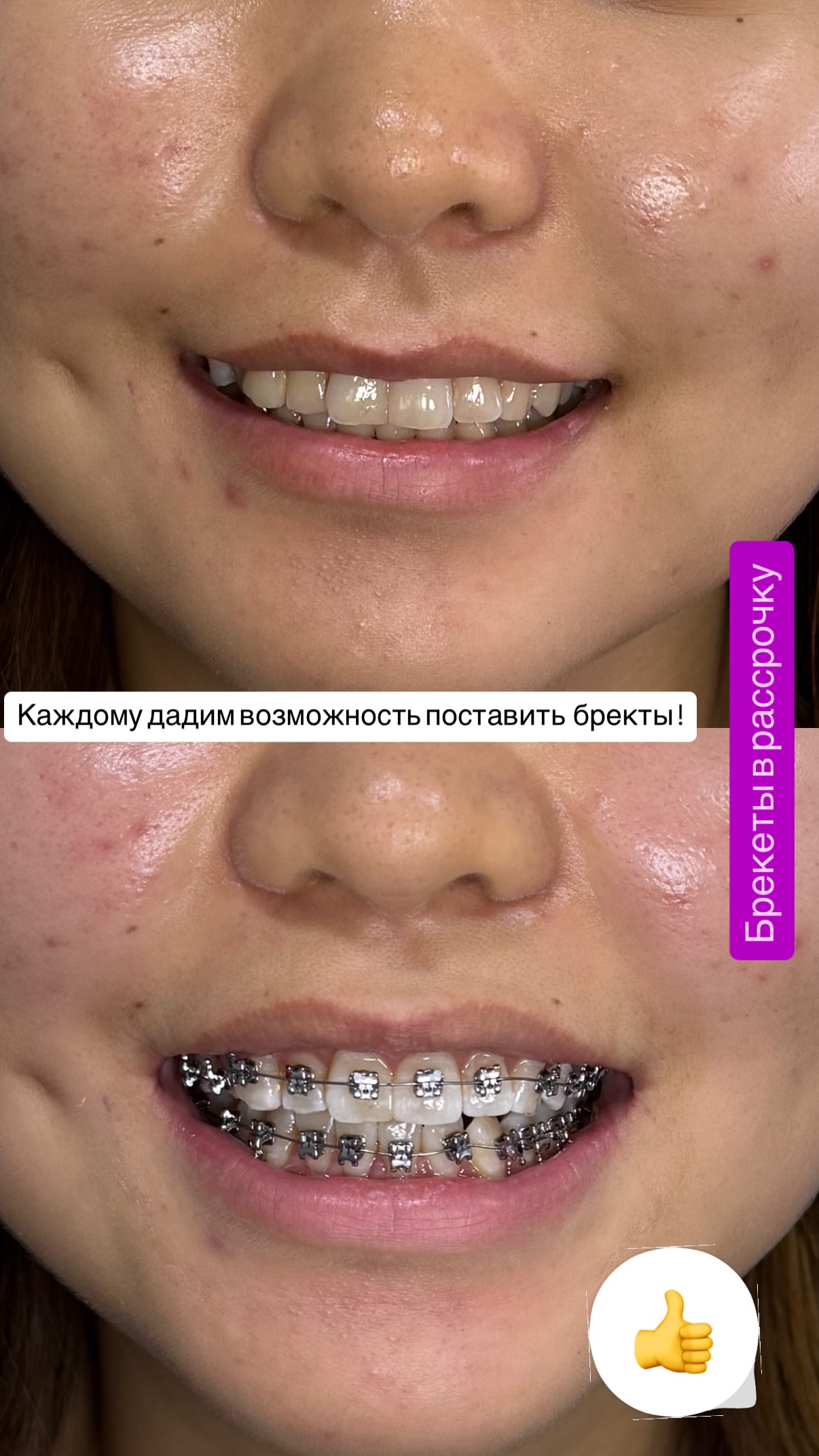 До/после 2024 — кейс 6