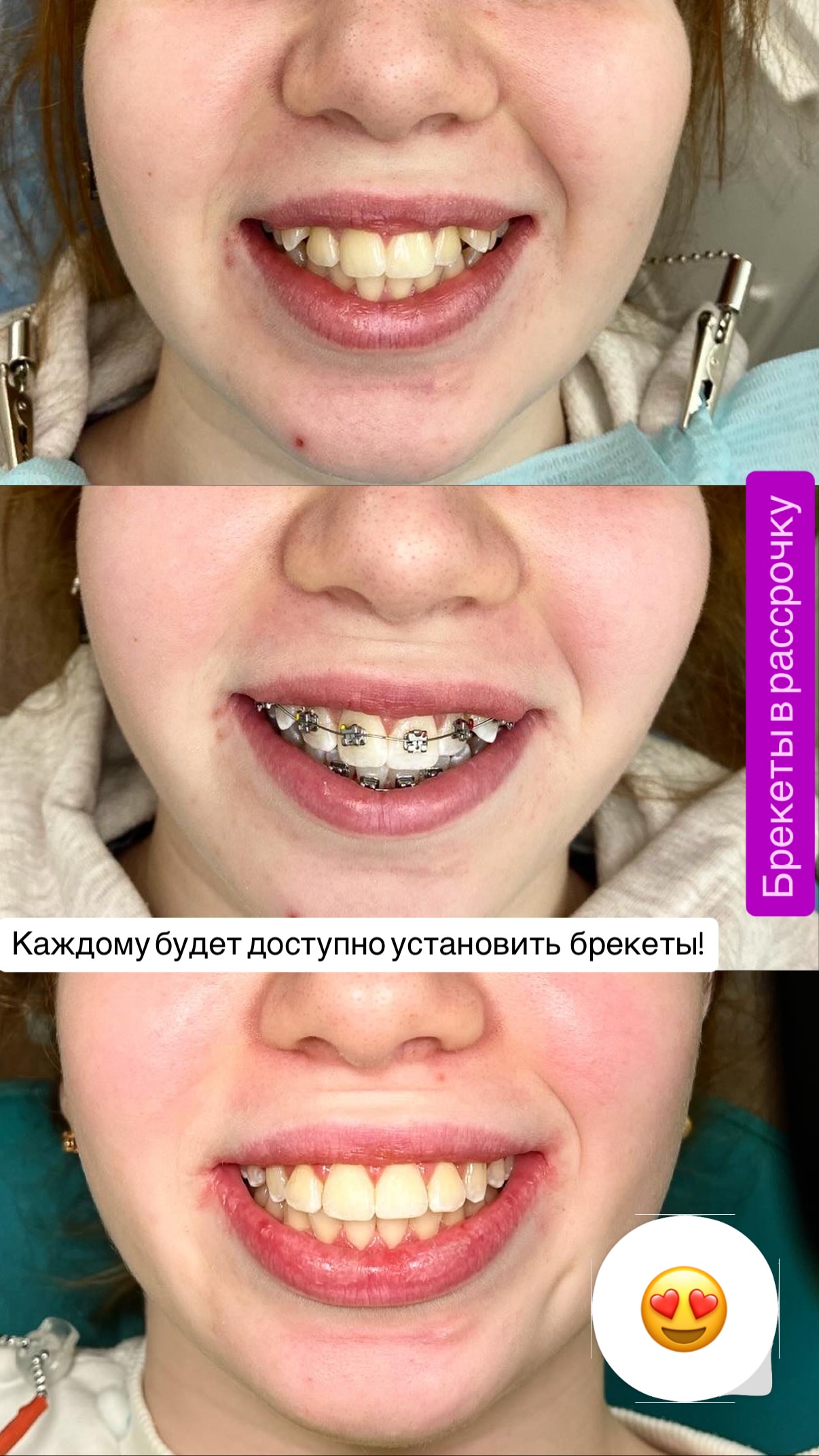 До/после 2024 — кейс 7