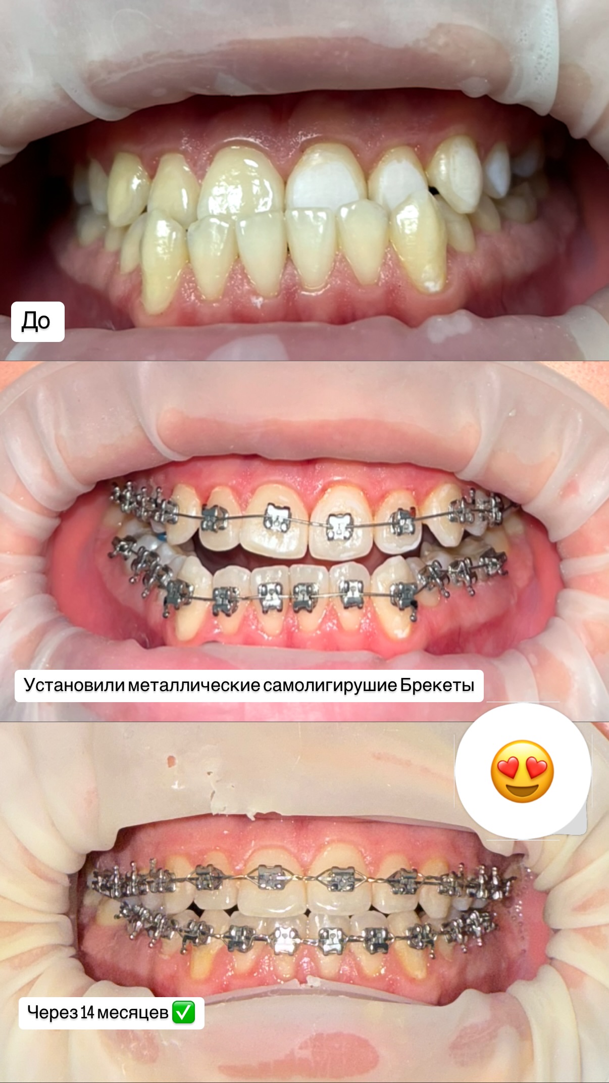 До/после 2024 — кейс 8