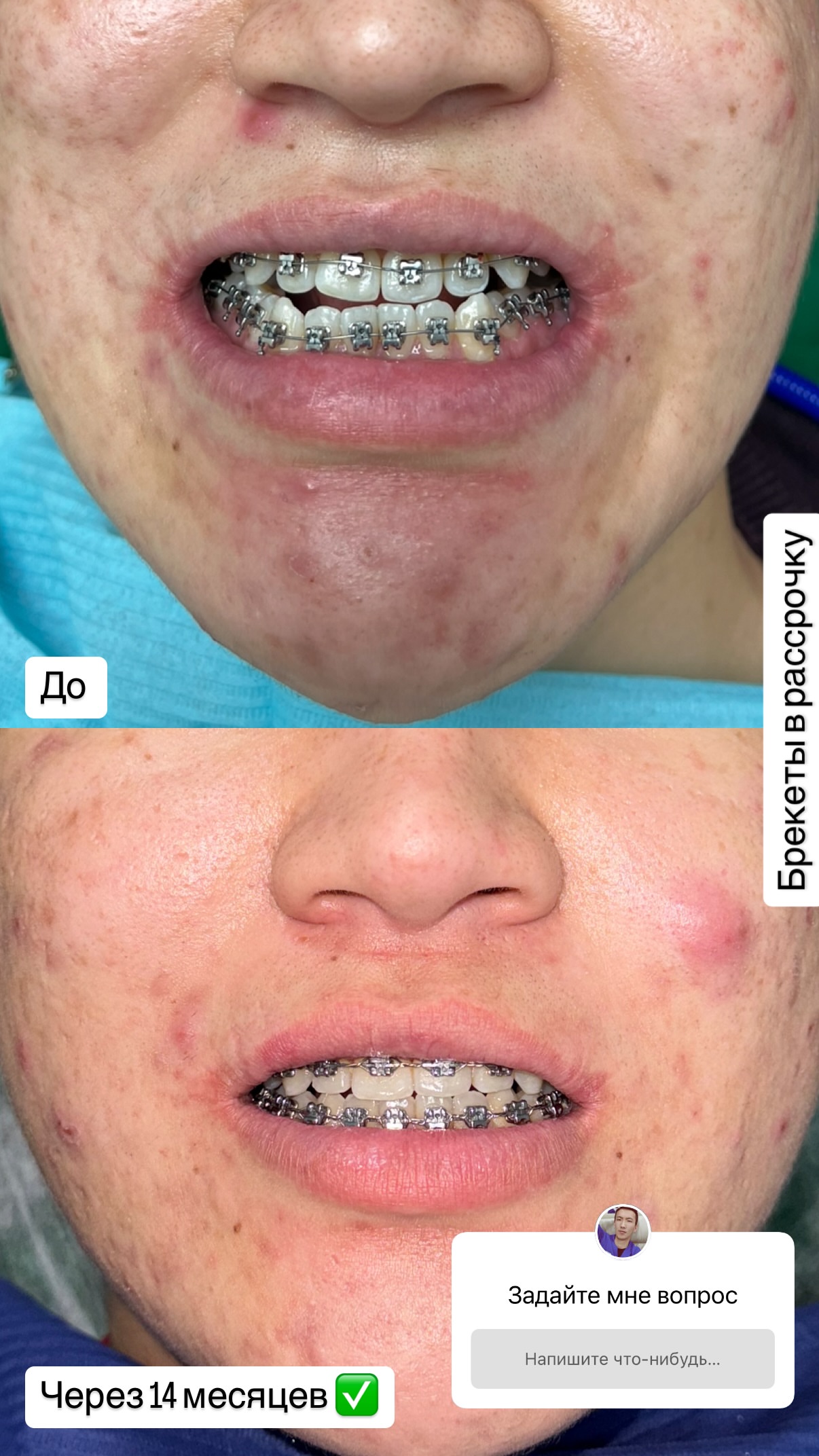 До/после 2024 — кейс 9