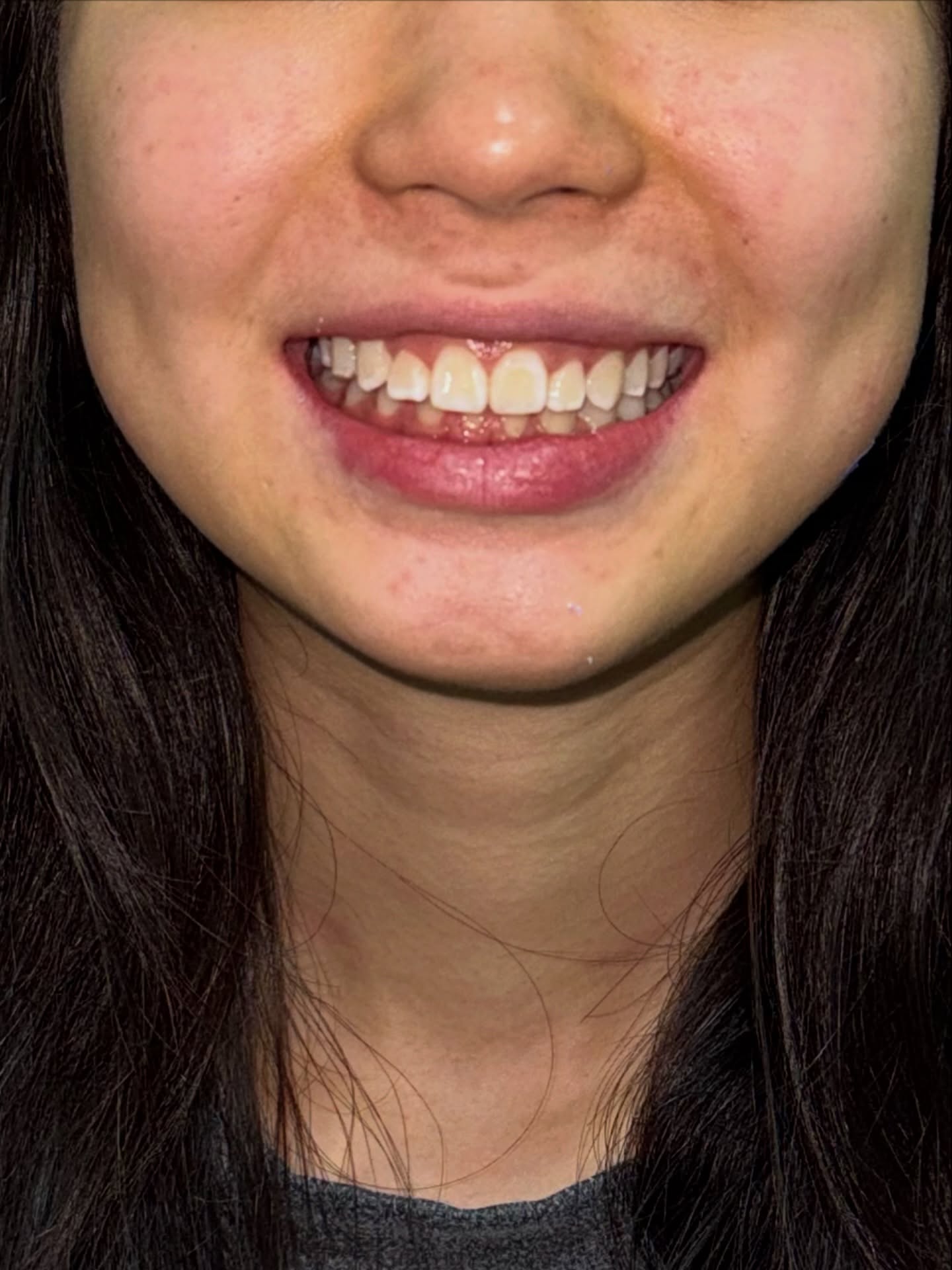 До и после — один из лучших кейсов, 16 лет, 1.5 года